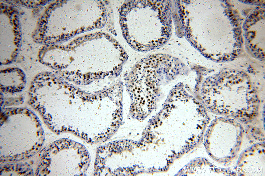 19893-1-AP;human testis