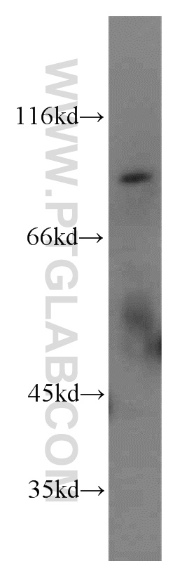 19893-1-AP;mouse lung tissue