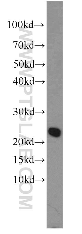 20188-1-AP;HeLa cell