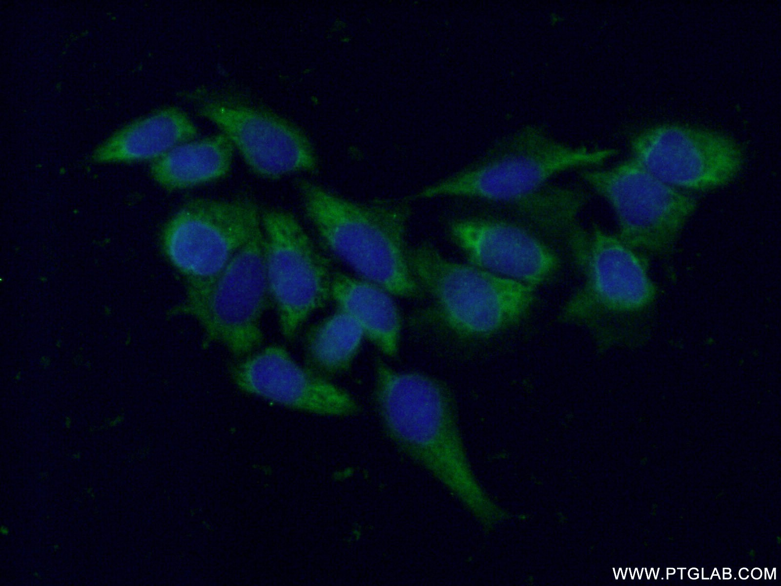 10749-1-AP;HeLa cells