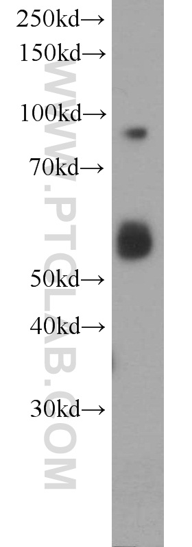 16388-1-AP;HeLa cell