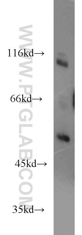 15366-1-AP;mouse brain tissue