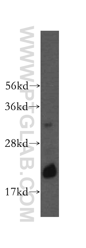 16518-1-AP;human testis tissue