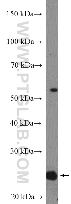 16948-1-AP;mouse brain tissue