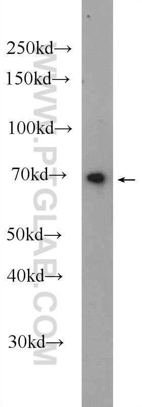 25165-1-AP;mouse kidney tissue