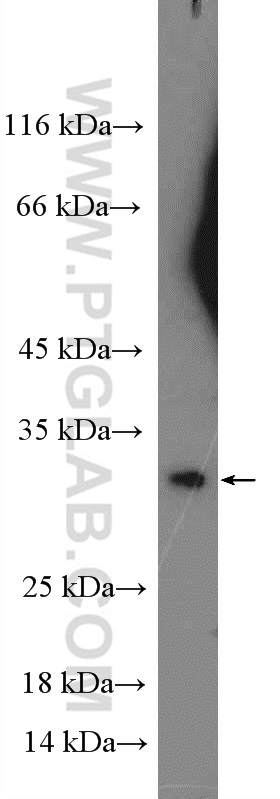 26306-1-AP;HeLa cells