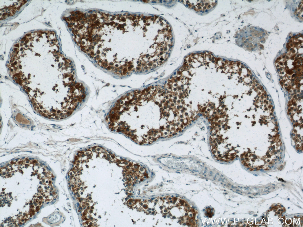 24708-1-AP;human testis tissue