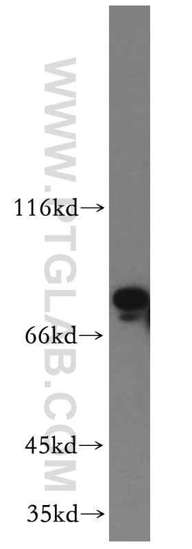 20437-1-AP;mouse testis tissue