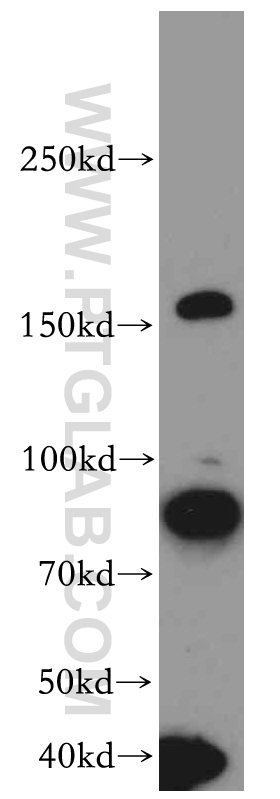 20247-1-AP;HeLa cell