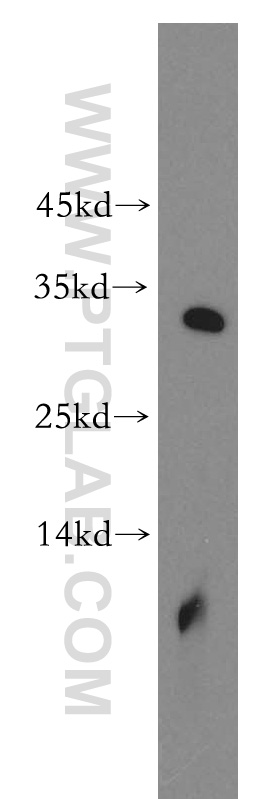 17047-1-AP;human brain tissue