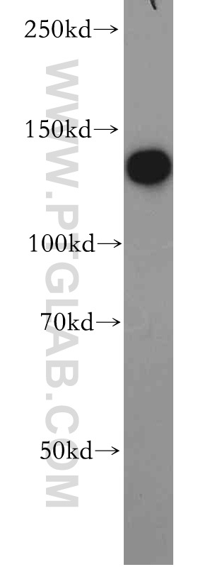 20629-1-AP;K-562 cell