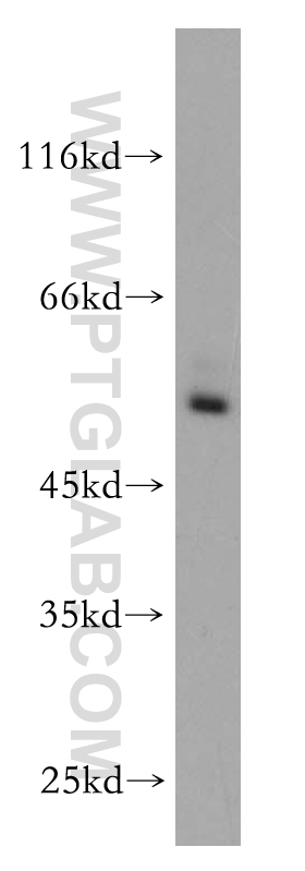 13205-1-AP;HEK-293 cells