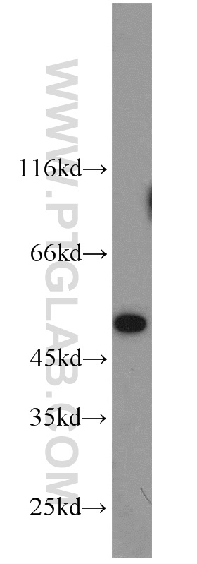 10847-1-AP;MCF7 cells