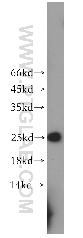 12168-2-AP;mouse thymus tissue