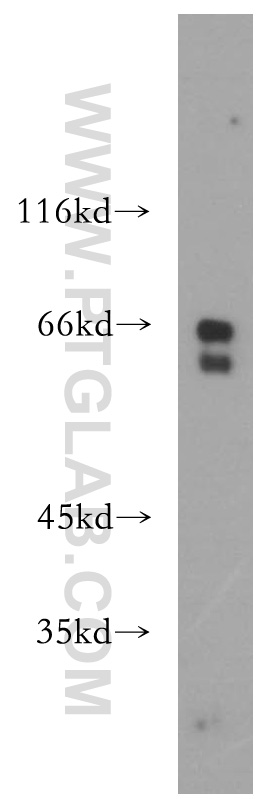 17939-1-AP;Y79 cell