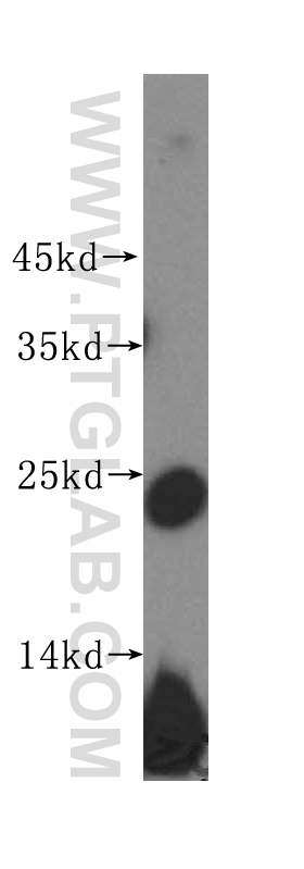 17013-1-AP;mouse thymus tissue