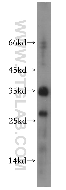 14633-1-AP;HeLa cells