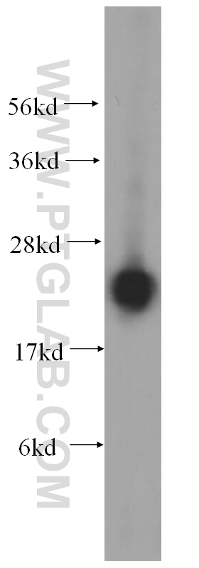 14991-1-AP;HeLa cell