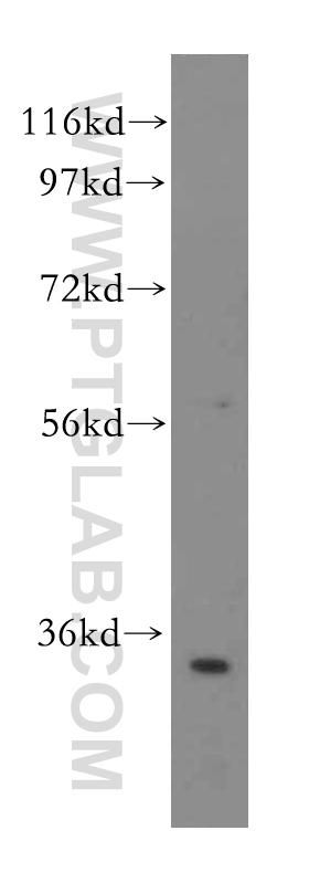 15387-1-AP;HepG2 cells