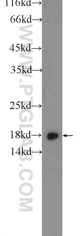 14831-1-AP;SH-SY5Y cells