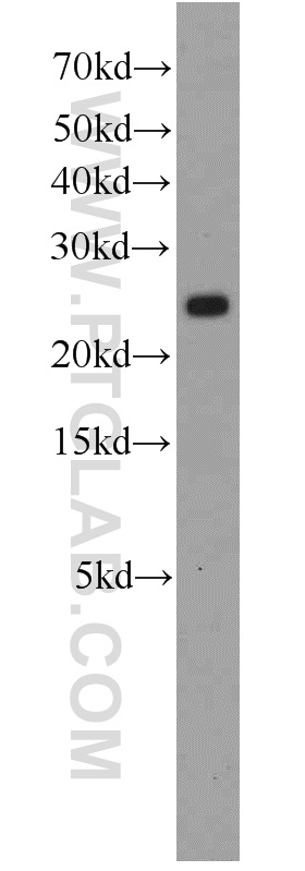 16964-1-AP;HeLa cells