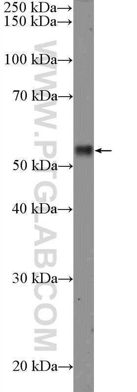 26194-1-AP;MCF-7 cells