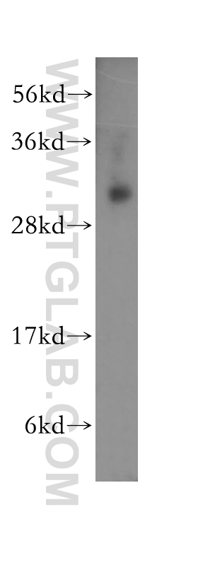 11365-1-AP;K-562 cells