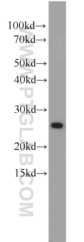 11126-1-AP;COLO 320 cell