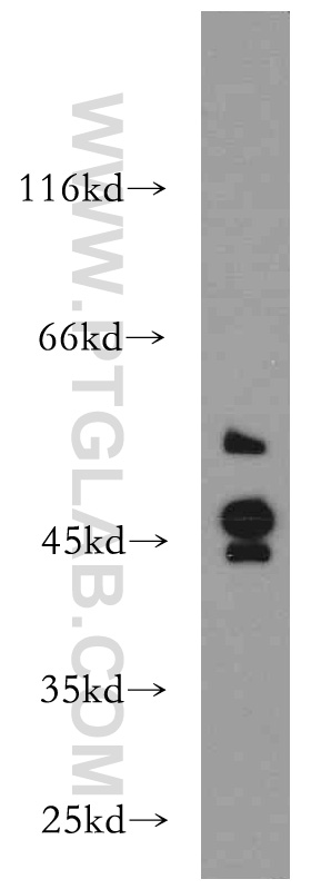 21180-1-AP;MCF7 cell