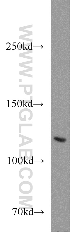 55085-1-AP;mouse lung tissue