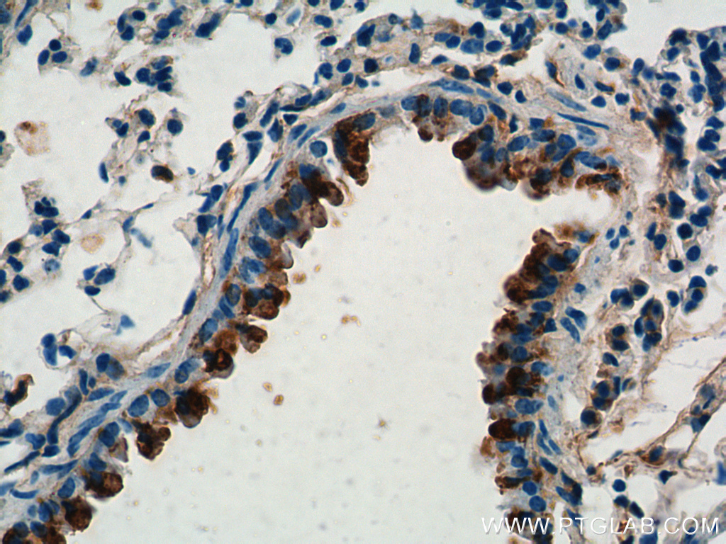 10490-1-AP;mouse lung tissue