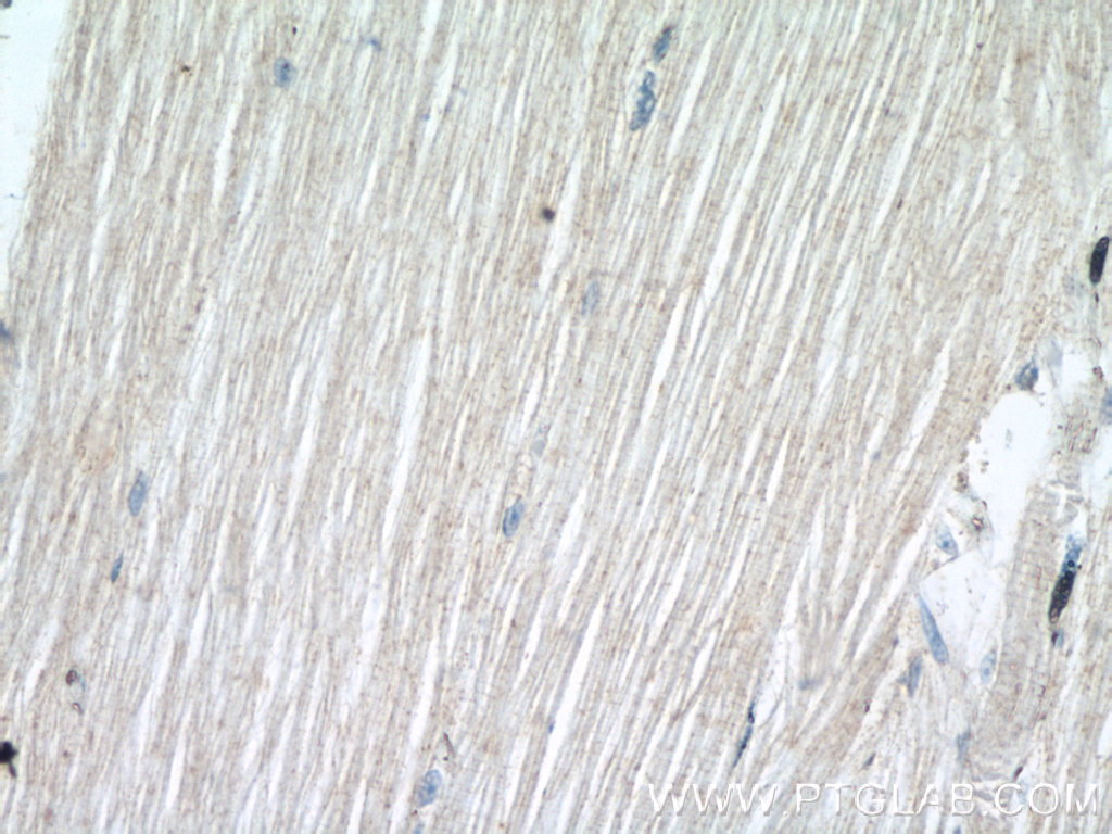 55438-1-AP;human skeletal muscle tissue