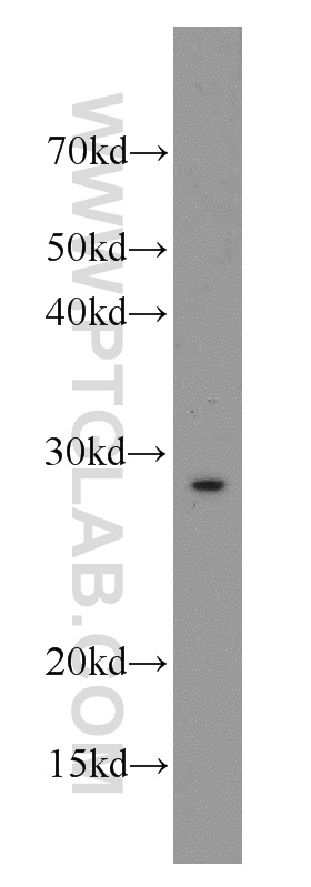 55438-1-AP;mouse heart tissue