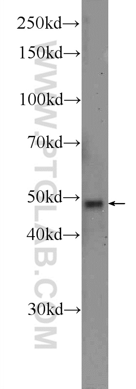 14303-1-AP;A549 cells