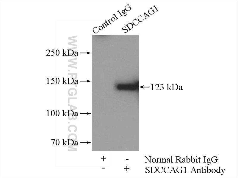 11840-1-AP;A549 cells