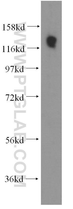 11840-1-AP;A549 cell