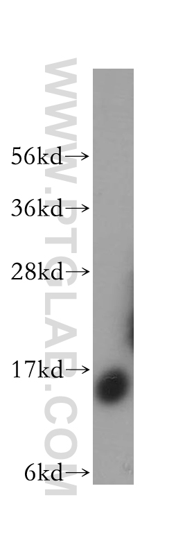 14575-1-AP;human liver tissue