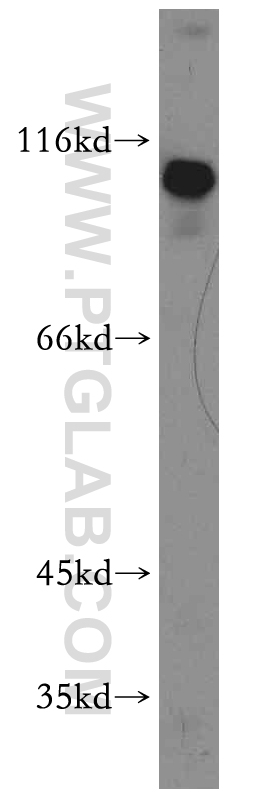 19529-1-AP;HeLa cell