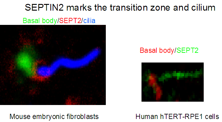 11397-1-AP;hTERT-RPE1 cells and Mouse embryonic fibroblasts