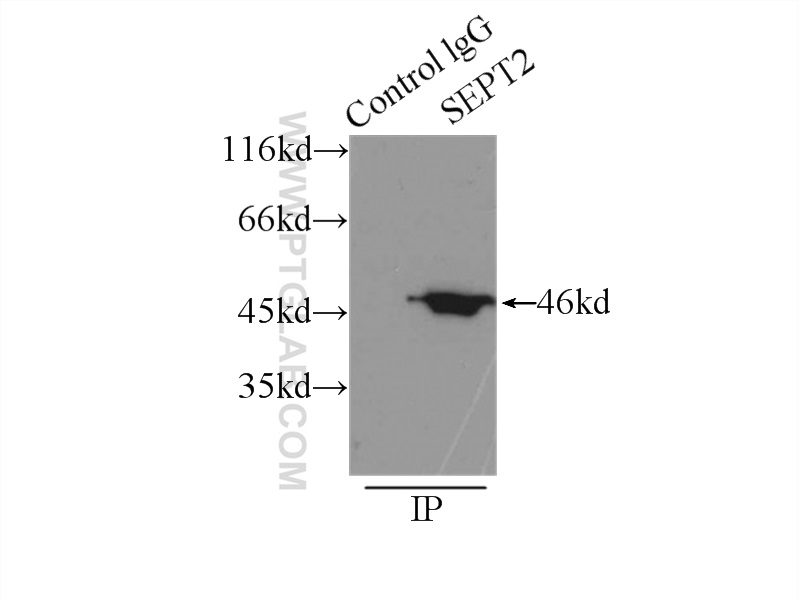 11397-1-AP;mouse brain tissue