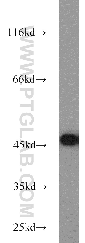 11397-1-AP;HeLa cells