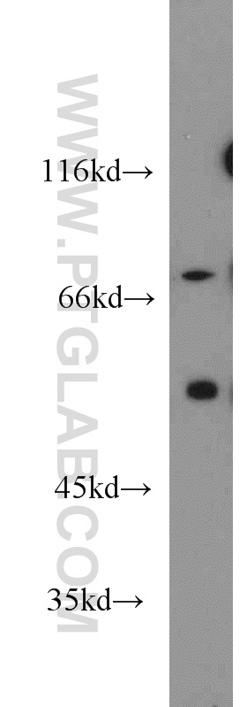 20267-1-AP;mouse pancreas tissue