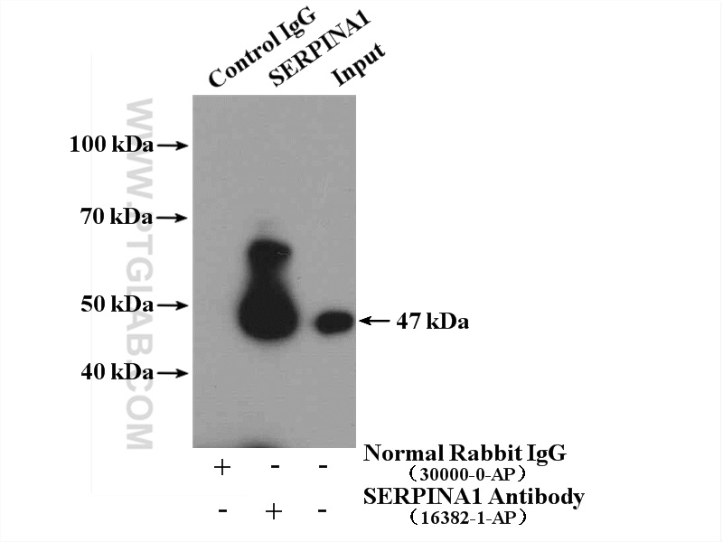 16382-1-AP;mouse kidney tissue