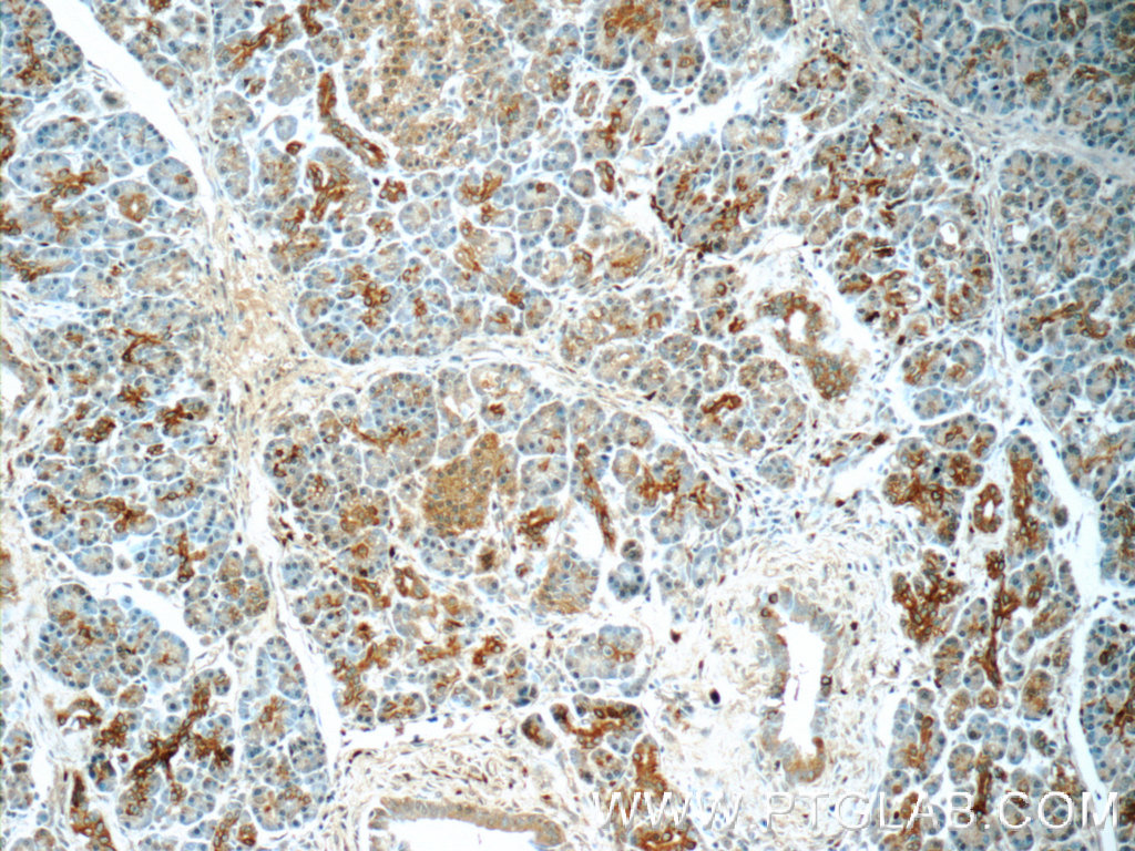 21719-1-AP;human pancreas tissue