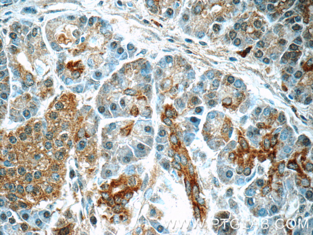 21719-1-AP;human pancreas tissue