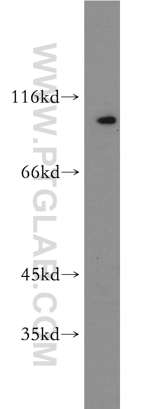 21719-1-AP;mouse spleen tissue