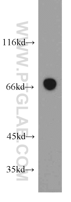 21668-1-AP;human skeletal muscle tissue