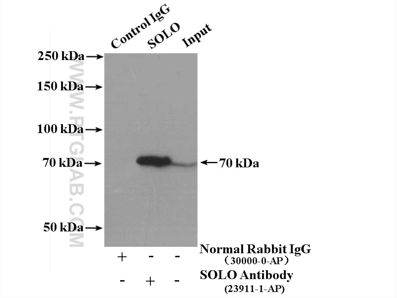 23911-1-AP;mouse brain tissue