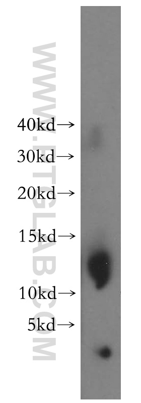 15525-1-AP;human adrenal gland tissue