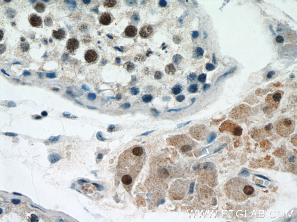 15614-1-AP;human testis